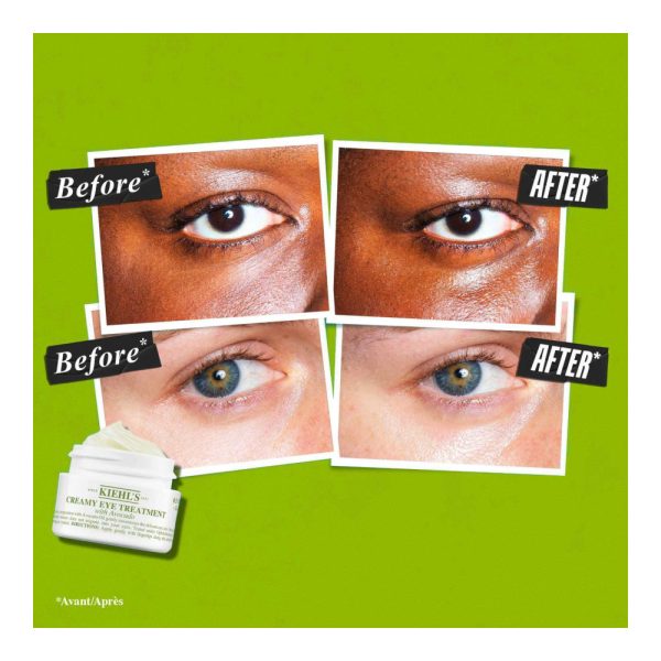KIEHL’S – Creamy Eye Treatment with Avocado – Crème contour des yeux à l’avocat – 14 ml 3 KIEHL’S – Creamy Eye Treatment with Avocado – Crème contour des yeux à l’avocat – 14 ml 3